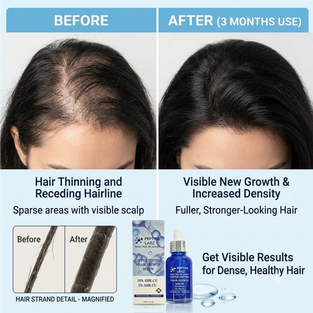 Haarwuchs-Essenz Kupferpeptid  – Peptide Complex Serum Bewertung und Preis